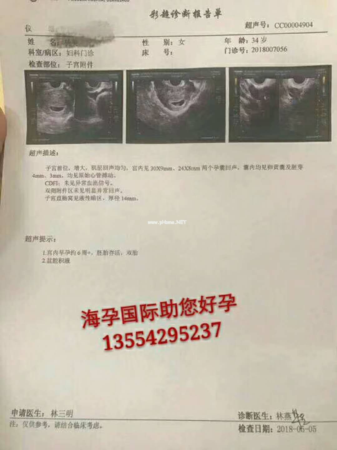武汉海孕国际试管婴儿